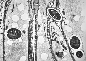 F, 1m. | sepsis - mycotic dermal lesions